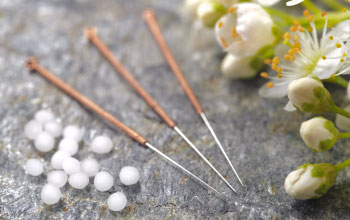 Acupuncture